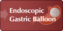Endoscopic Gastric Balloon, London UK