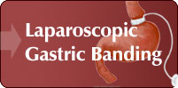 Laparoscopic Gastric Banding, London UK
